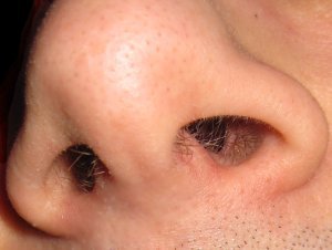 🭪 🭍🭲🬲 🮫 🬛🬕 🮲🮳